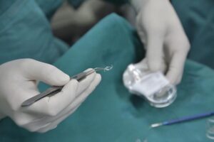 Is cataract surgery covered by star health insurance 